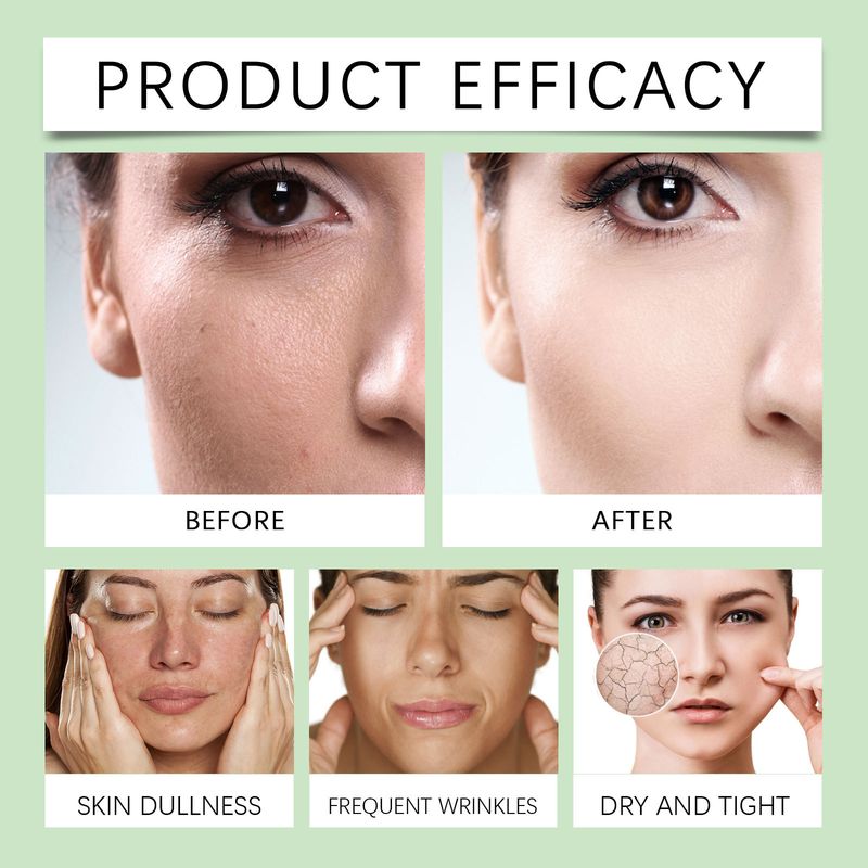 HOYGI Refreshing Firming Face Cream hydrateert, verbetert de stevigheid, verzacht en verheldert de huid_voghion.com