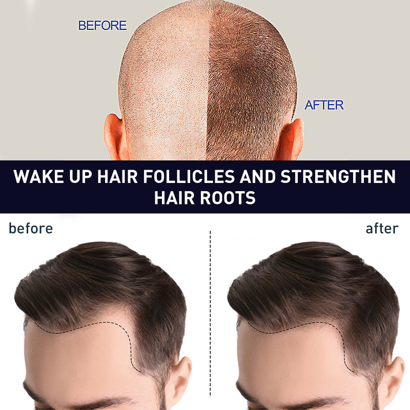 OUHOE Massaggio alle erbe Idratante Radice dei capelli del cuoio capelluto Resistente e morbida Essenza per la cura della barba densa_voghion.com