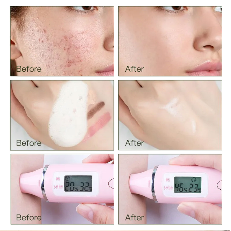 Mousse alla rosa BUPY Rinfrescante Controllo olio Pulizia Trucco Rimozione idratante Latte detergente viso 2024_voghion.com