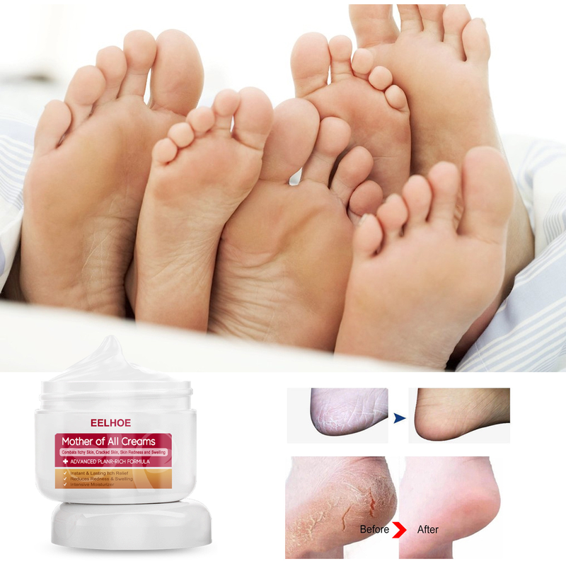 EELHOE Hand and Foot Moisturizing Repair Cream relieves itching, relieves itching, repairs dandruff, moisturizes and moisturizes the skin_voghion.com
