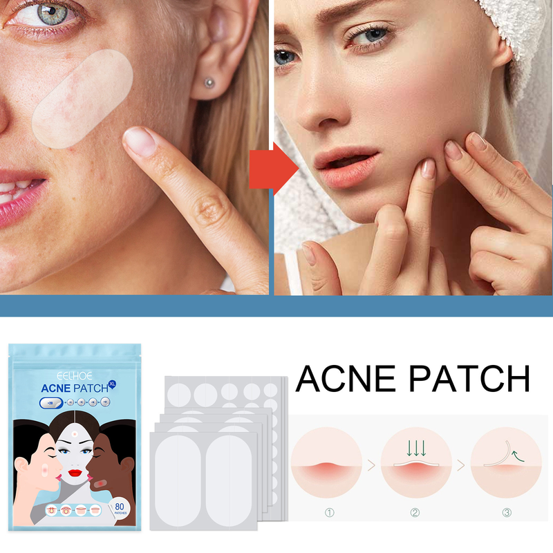 EELHOE Invisible Cleaning Patch Anti acne Closed mouth Acne Waterproof Topping concealer Hydrocolloid_voghion.com