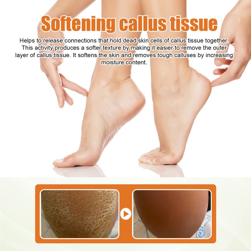 Spray exfoliant pour les pieds pour les peaux mortes, hydratant, nettoyant, réparateur, peau rugueuse et éliminant les callosités 2024 le plus populaire_voghion.com