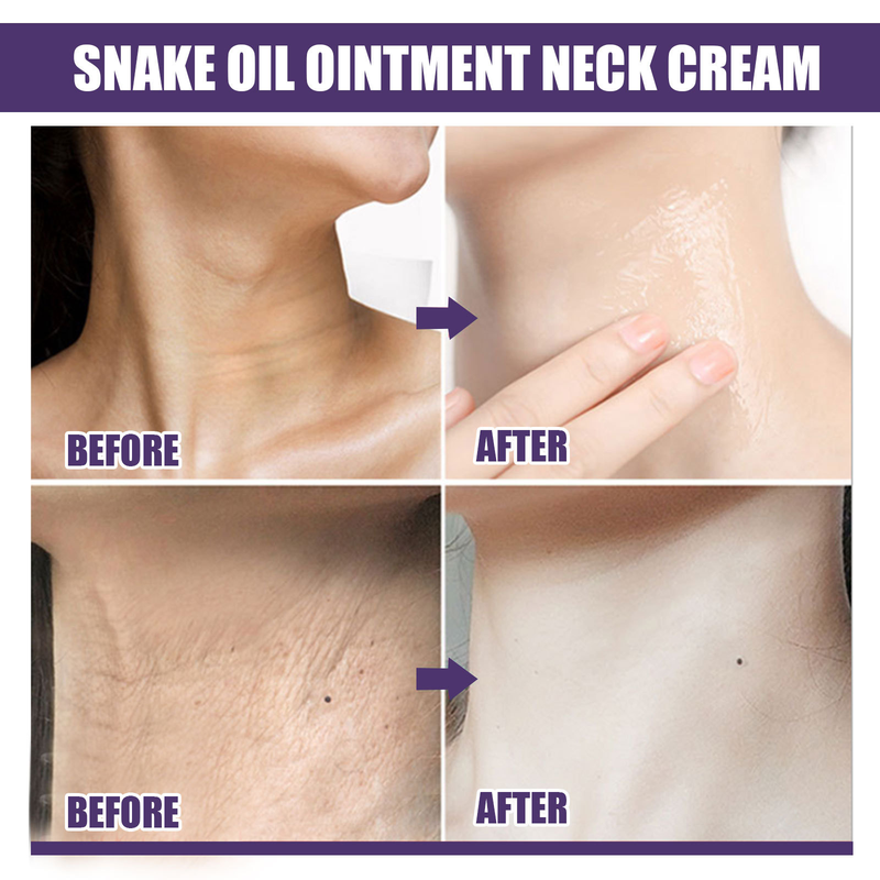 Crema eficaz para eliminar arrugas del cuello, crema reafirmante antienvejecimiento, decoloración del cuello, líneas finas, blanqueamiento, hidratación, cuidado de la piel suave, 15g_voghion.com