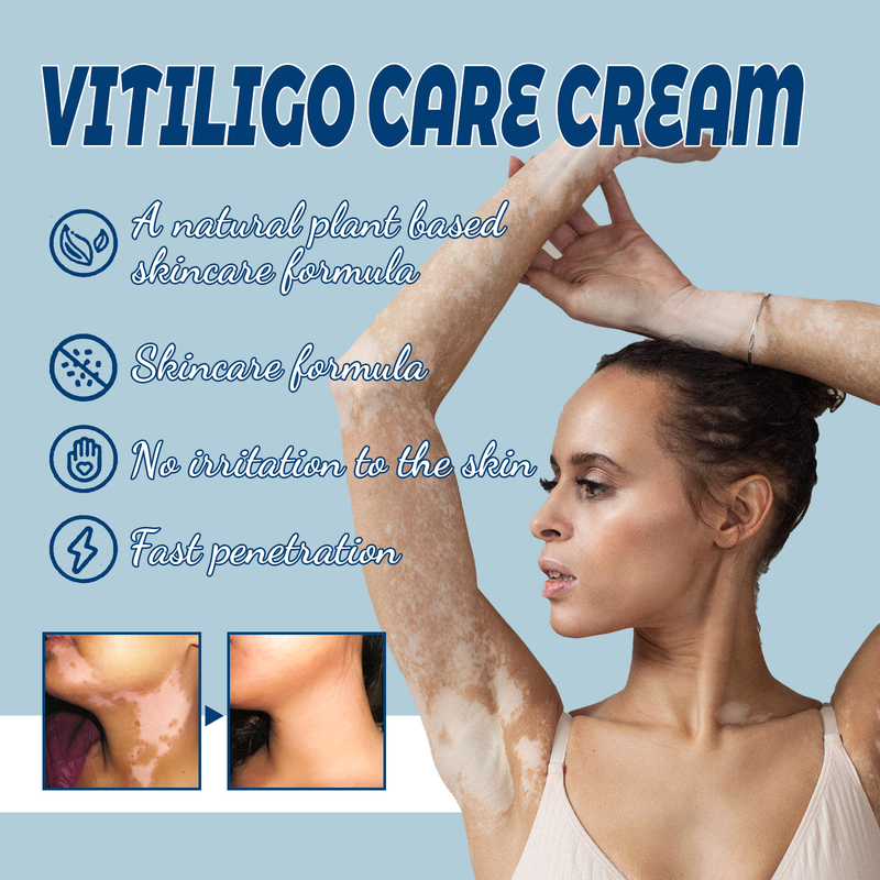 Reparatie Mooie Whitespot Cream voor het verlichten van witte vlekken, bloemvlekken, zweetvlekken Huidreparatie, verenigende huidskleur,_voghion.com