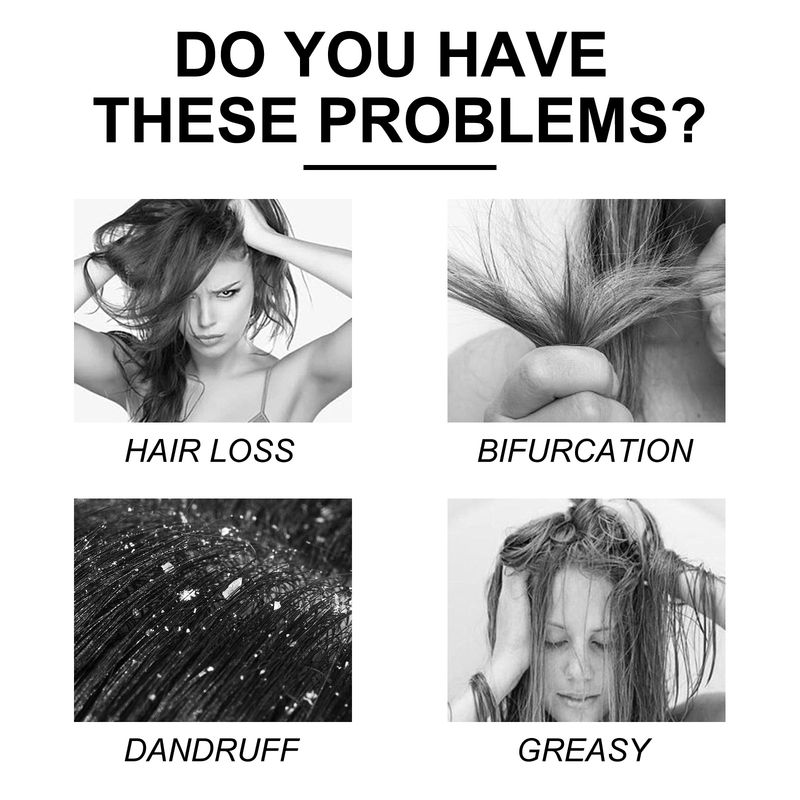 Coconut Oil Shampoo, Cleansing Scalp Nourishing Hair Care Shampoo_voghion.com