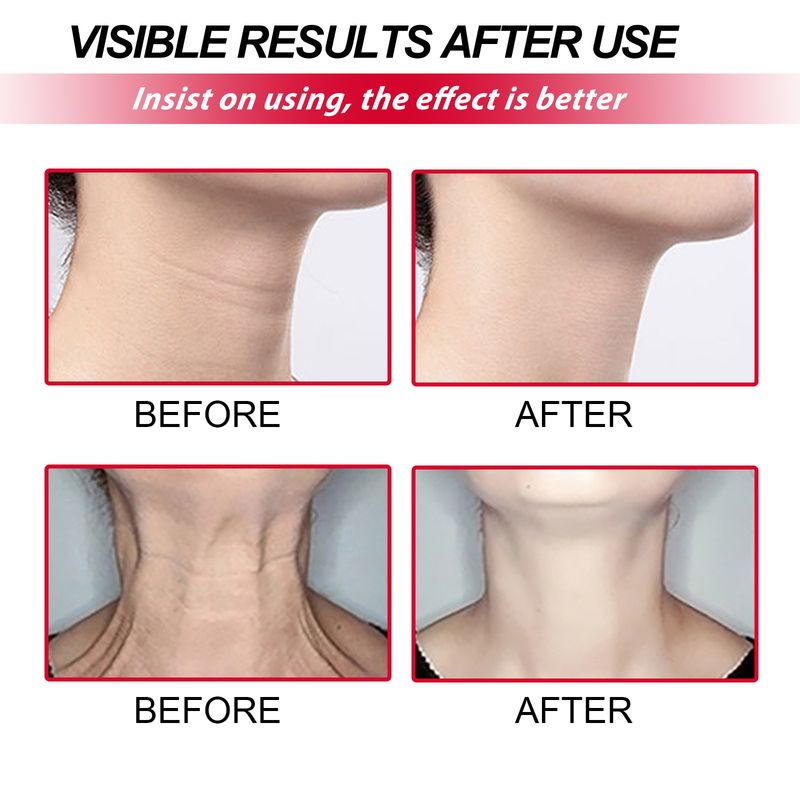 EELHOE Retinol Neck Rollerball, Moist Smooth Neck Wrinkle Wrinkle Firming Neck Reshape The Swan Neck_voghion.com