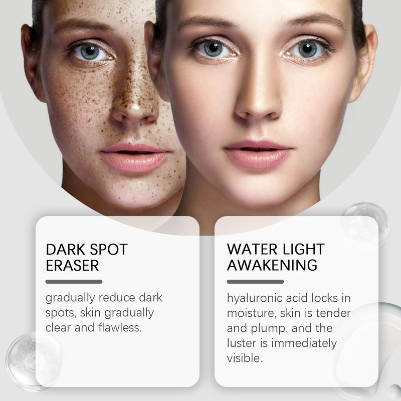 HOYGI Dark Facial Moisturizing And Hydrating Apply Skin Spot Care Lotion_voghion.com