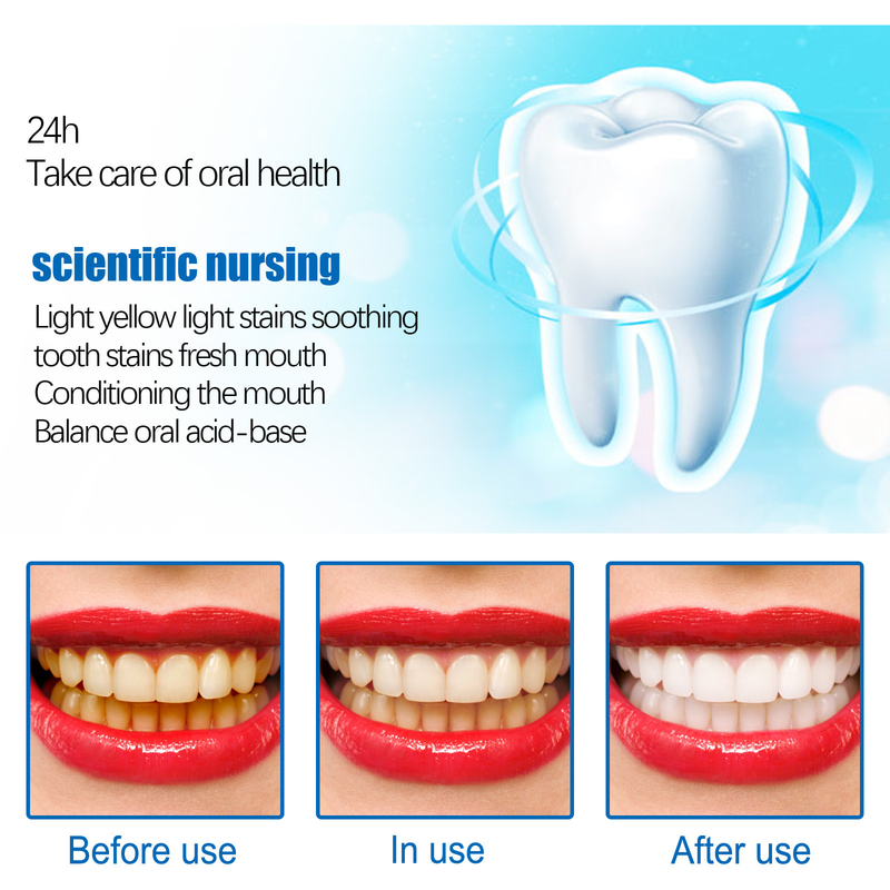 Tooth essence beautiful Tooth Whitening and Brightening Tooth Care Solution Tooth Spot Stains Stain Oral Cleaning Bad B_voghion.com