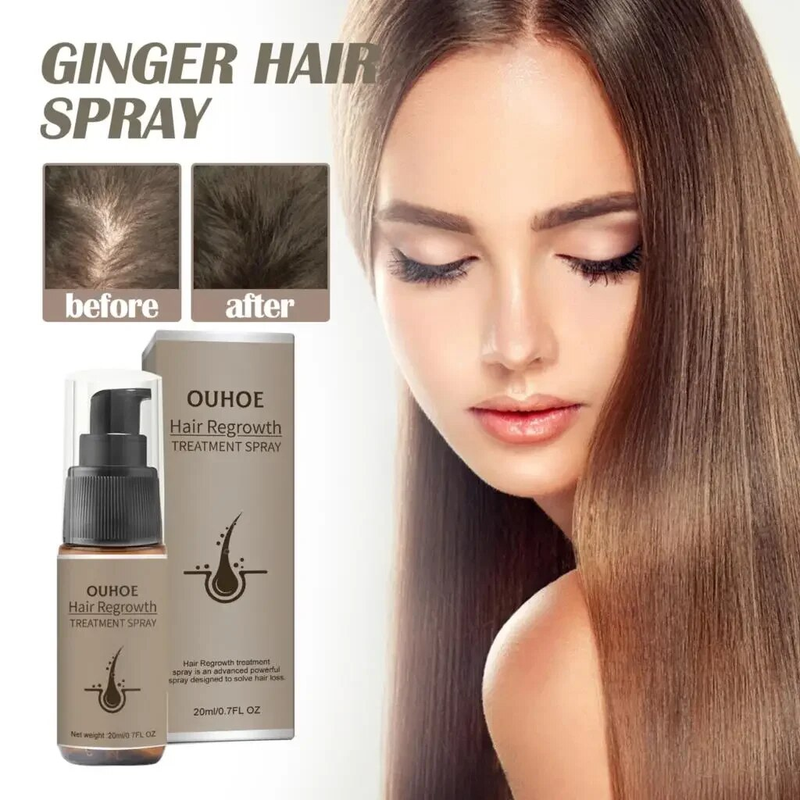 Snabb hårväxt Sprayprodukter Anti-håravfall Serum Förhindrar skallighet Behandling Hårbotten Torr skadad eterisk olja Hårskönhet_voghion.com