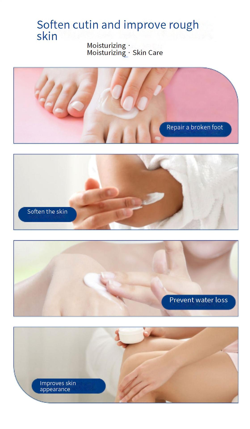 Lotions ARTKEN Crème à l'urée 42 % d'acide salicylique Automne et hiver Crème hydratante anti-dessèchement pour les mains Full English Spot_voghion.com