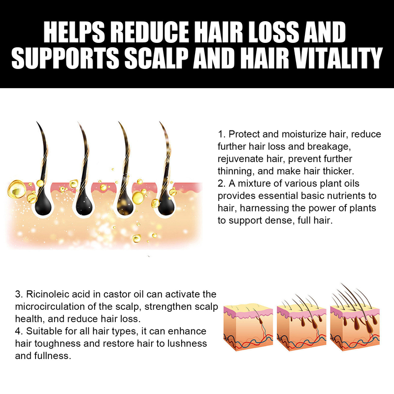 OUHOE Dense idrata le radici, ripara i capelli, ripara l'olio essenziale per la cura dei capelli danneggiati, secchi e furiosi_voghion.com