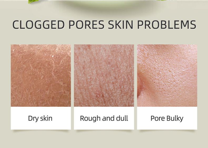 Tratamentos e Máscaras Laike Longjing Matcha Mud Mask Matcha Refrescante Hidratante Embalagem em Inglês_voghion.com