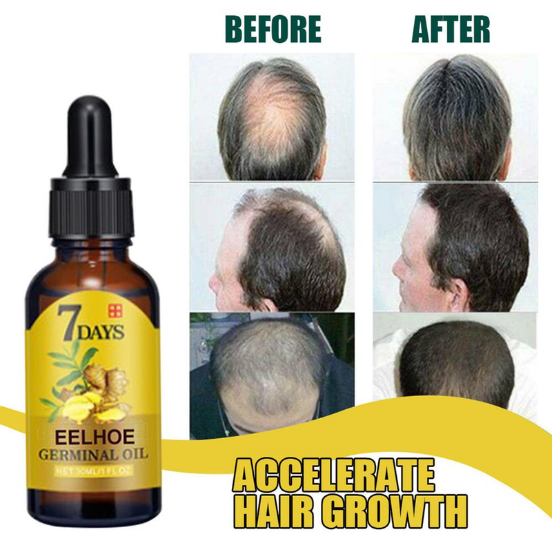 Growth Serum Oil 10/20/40Ml Tät regenerering Ginger Hårvård Reparation Vätska Essential Anti Loss_voghion.com
