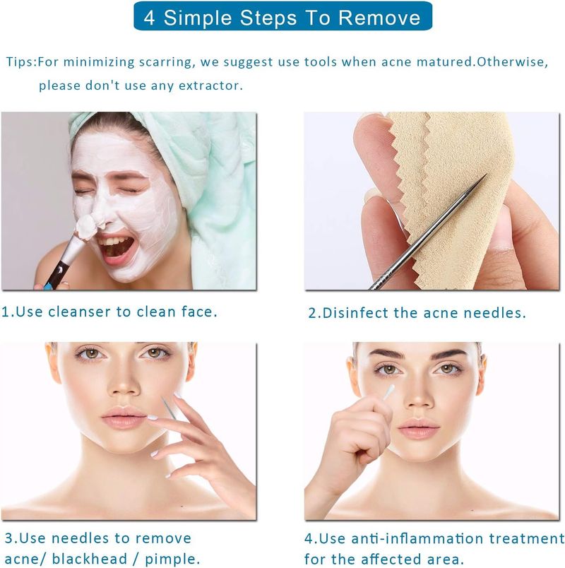 5 estrattori di comedoni, kit di pinzette curve per punti neri, kit di strumenti professionali in acciaio inossidabile per la rimozione dell'acne_voghion.com