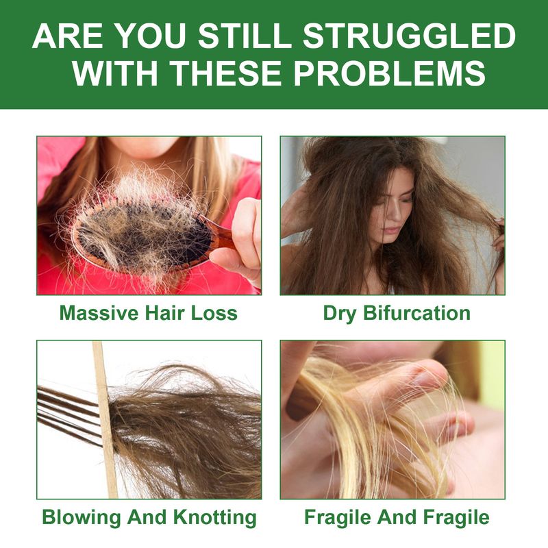 WoodSleep per riparare i capelli, idratare le radici dei capelli e olio essenziale per l'attaccatura dei capelli_voghion.com