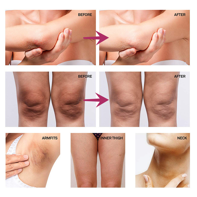 cream whitening for repairing underarm joints, lightening melanin, moisturizing, and rejuvenating the s_voghion.com