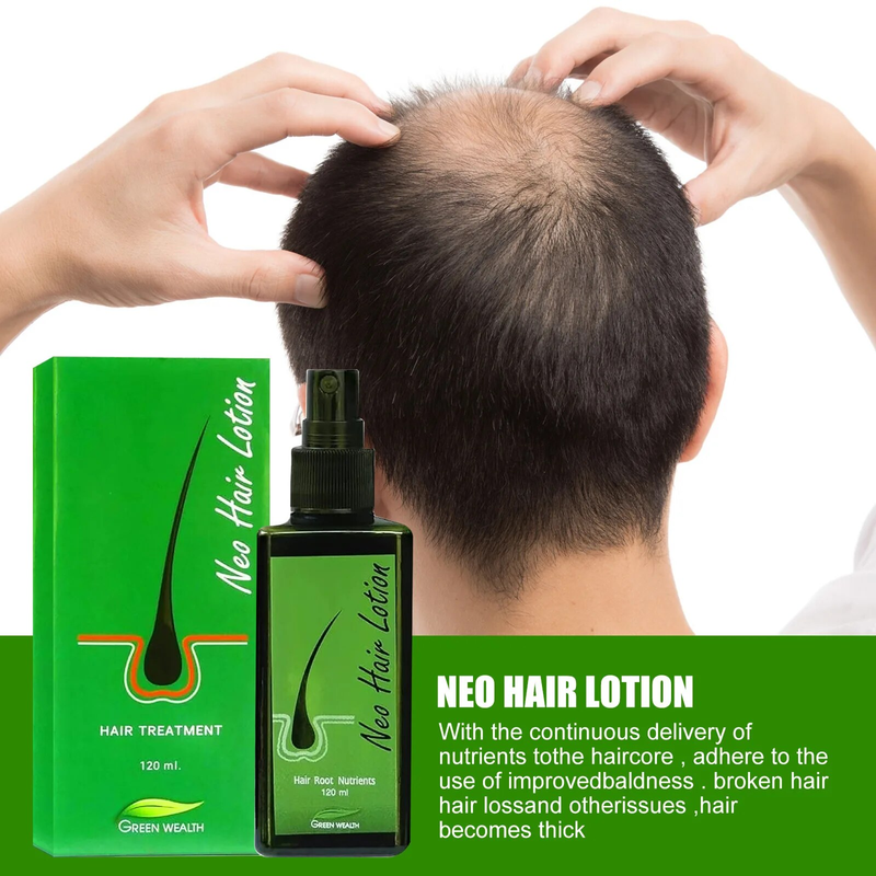 Growth Original Neo Uniex Anti Hair Lo Pilatory Natural Extract Baldne Lotion Eence Oil Repair Grow Spray tion_voghion.com