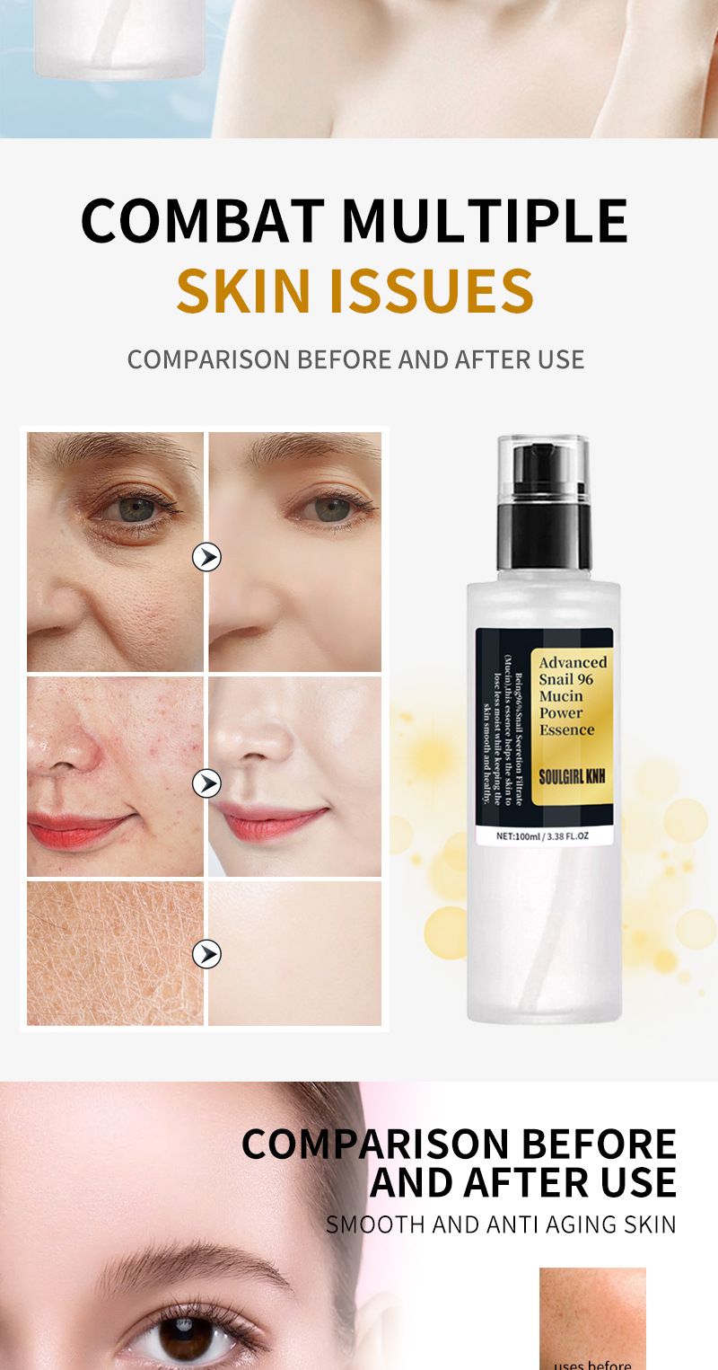 Serum Collagen Snail Face Essence Original Solution spendet Feuchtigkeit und hellt den Hautton auf_voghion.com