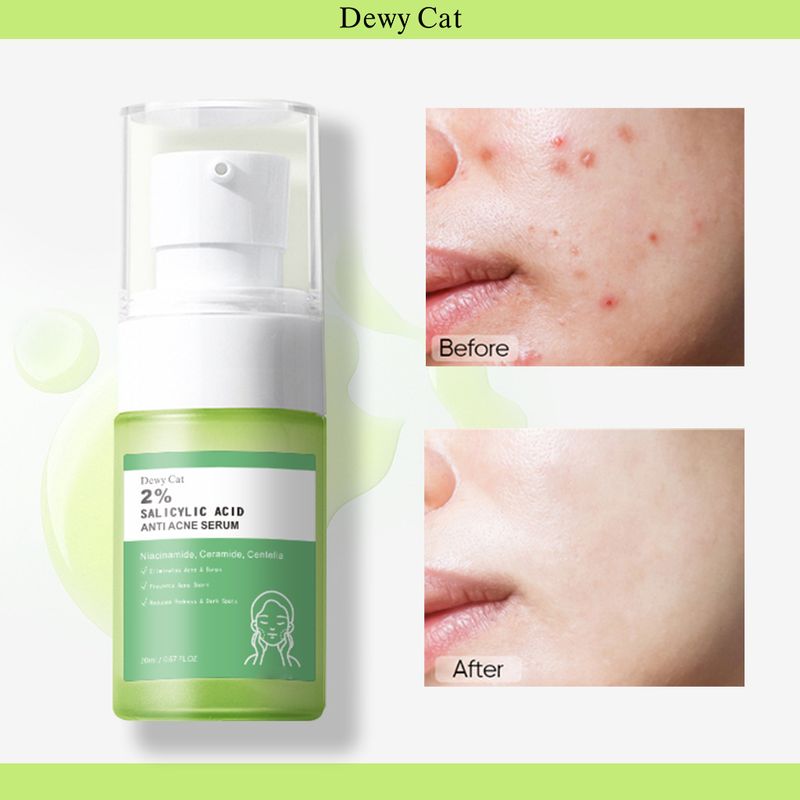 Dewy Cat Aufhellendes Serum mit Salicylsäure – Komplettes Englisch_voghion.com