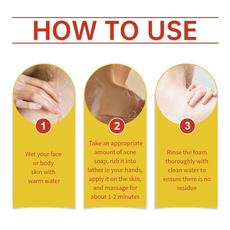 Jaysuing Acne Cleansing Soap Gently Cleanses Back Pimples Smooth And Refreshing Cleansing Soap_voghion.com