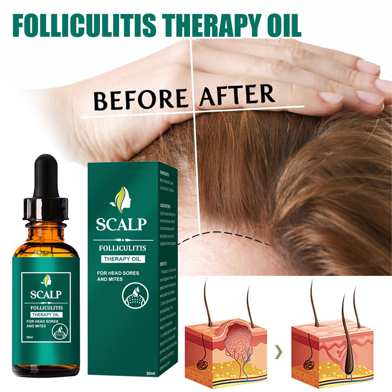 Nettoyage en profondeur du cuir chevelu réparant les racines, soulageant les démangeaisons, prévenant la perte des cheveux denses et fixant les soins capillaires_voghion.com