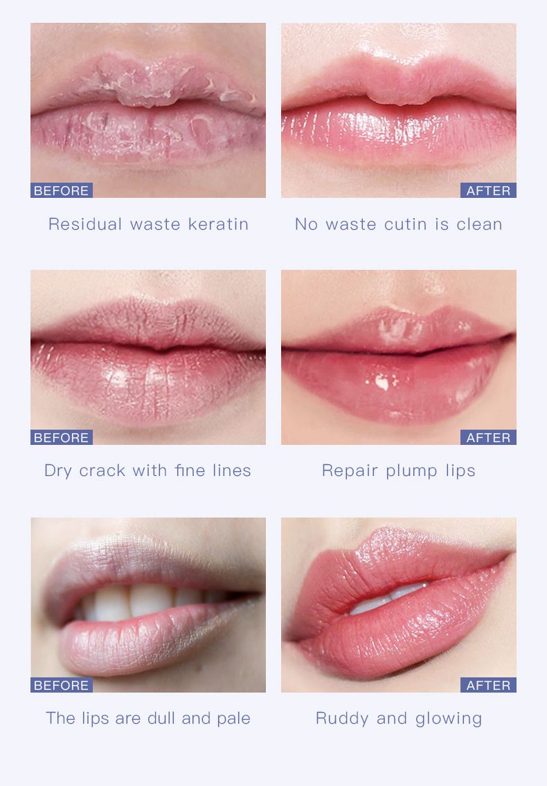 Bálsamo labial exfoliante, hidratante y suavizante con queratina de Pudaier. Tratamiento hidratante suave para labios suaves._voghion.com