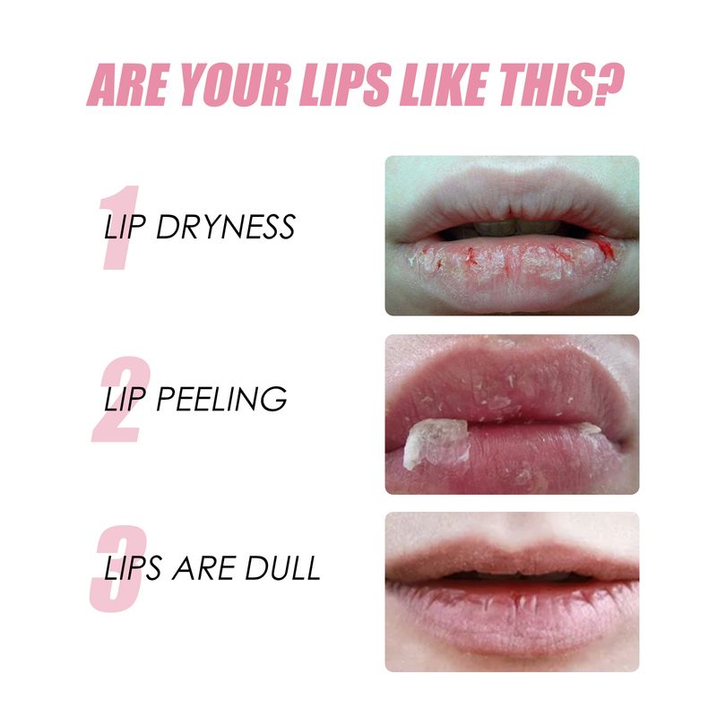 EELHOE Honey Infused Lip Oil, Moist Lips Fade Lip Lines Anti Cracking And Peeling Wet Lips_voghion.com