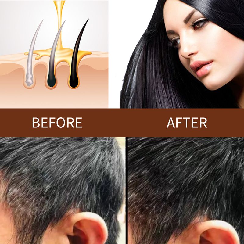 Shampoo per capelli Jayswing Polygonum Multiflorum Essence_voghion.com