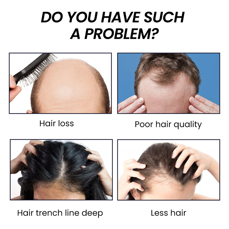 OUHOE anti drop essence, firming, repairing, root thickening, nutrition, tough scalp care, hair essence_voghion.com