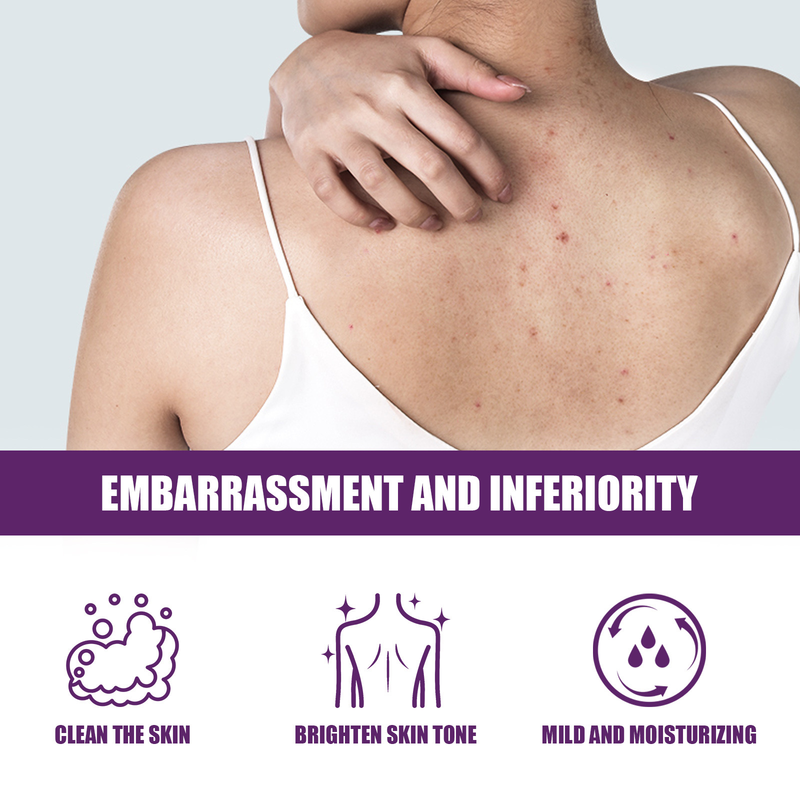 EELHOE Body Exfoliating gel Refreshes and Gently Cleans Back Acne Scrub to Improve Dark Bath Towels_voghion.com