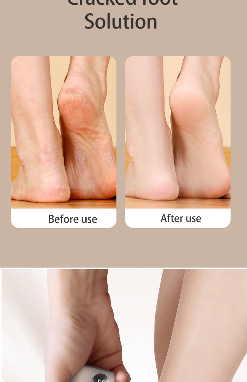 Moedor de pés elétrico, removedor de mini pedicure inteligente, máquina de pedicure recarregável para uso doméstico_voghion.com