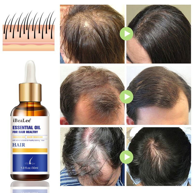 IBeaLee Hair Growth Liquid stärker återfuktar rötter, förbättrar näring, förhindrar förlust, stelnar hår och orsakar_voghion.com