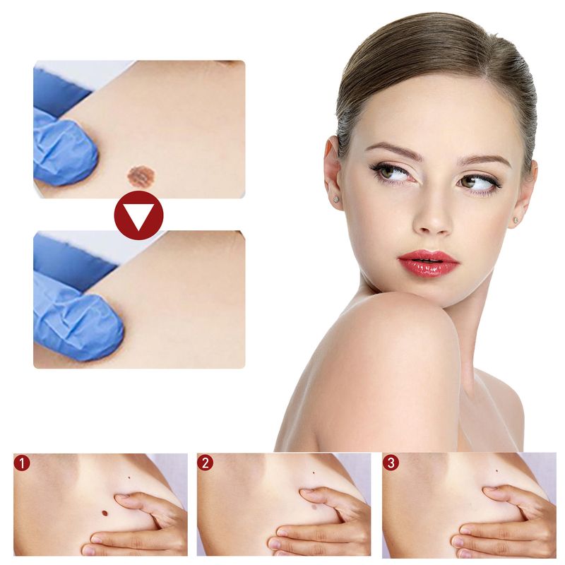 2025 Αντι-ελιές για βαθύ καθαρισμό του δέρματος, εξάλειψη κονδυλωμάτων, αφαλάτωση μαύρων ελιών, επανόρθωση και λείανση_voghion.com