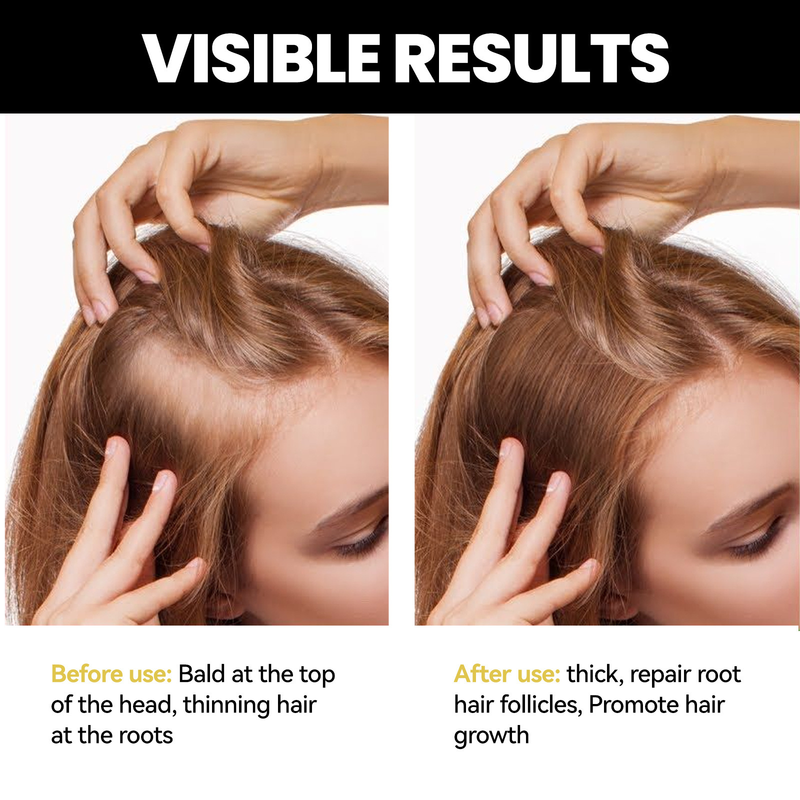 OUHOE Dense idrata le radici, ripara i capelli, ripara l'olio essenziale per la cura dei capelli danneggiati, secchi e furiosi_voghion.com