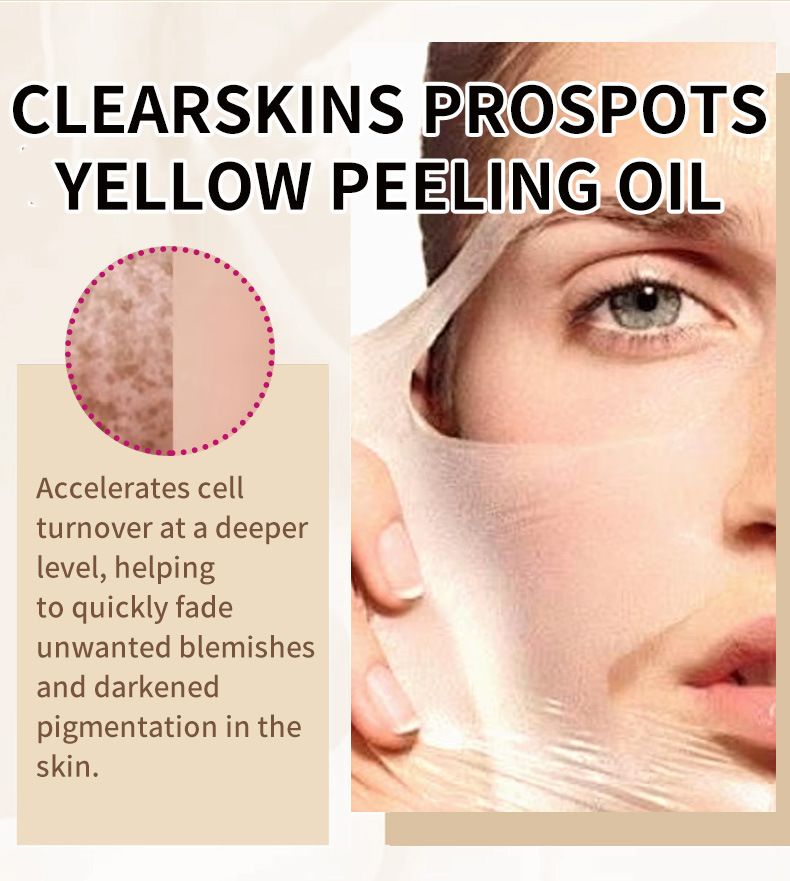 Voetverzorging Engelse Peeling Olie voor Handen en Voeten EXTRA STERKE PEELINGOLIE_voghion.com