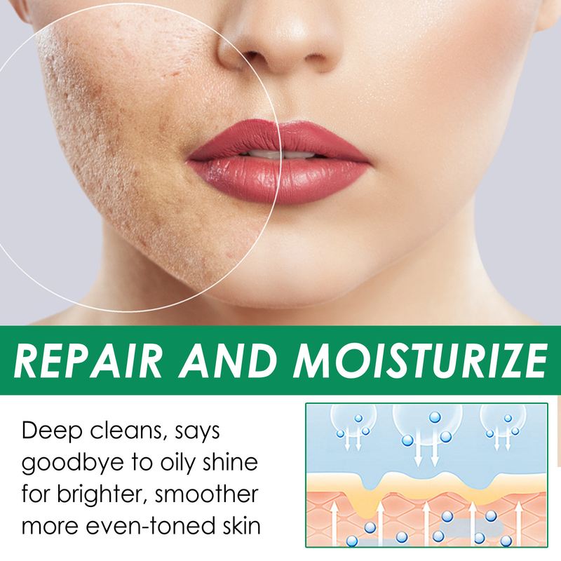 Téi OUHOE Gréng Vitamin Reinigungsmaske Gesiichtsakne Entfernt Déif Feuchtigkeitsspender Verschmierung Feinporenhaut_voghion.com