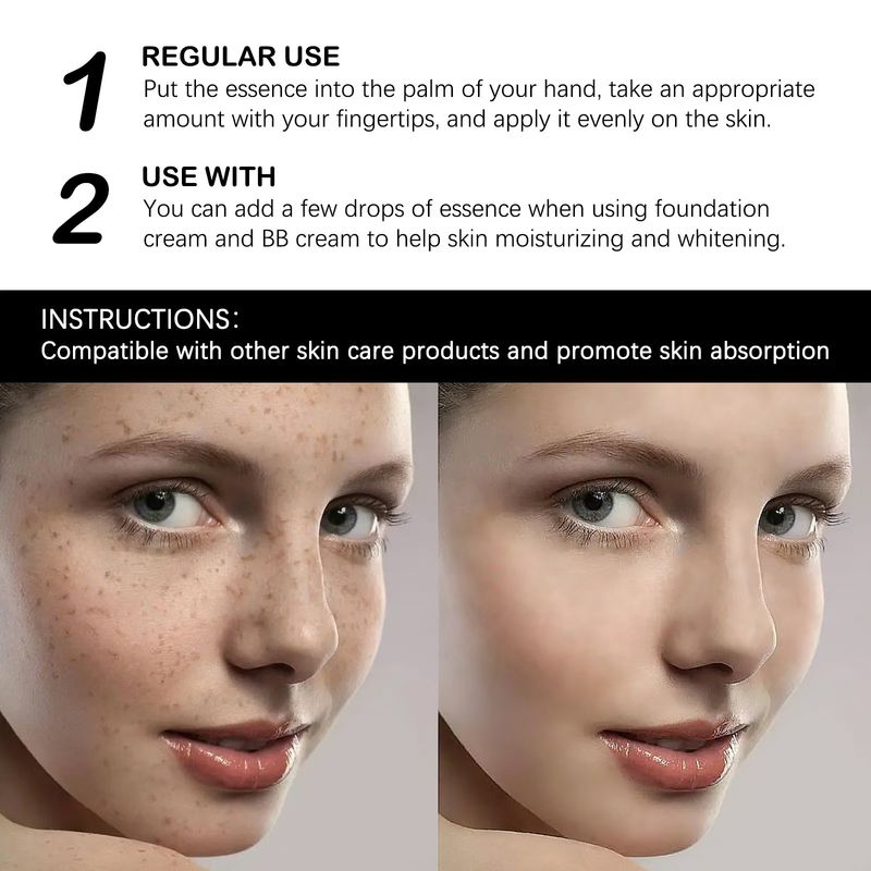 Curcumic acid can effectively fade and remove dark spots on the face essence oil_voghion.com