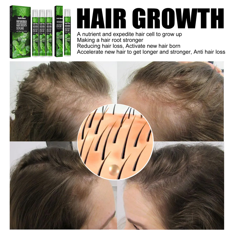 10/30 ml Haarwachstumsspray, schnell wachsendes Haaröl, Haarausfallkur für dünner werdendes Haar, Wachstumsspray, Produkte, Haarpflege für Frauen, Männer, Männer_voghion.com