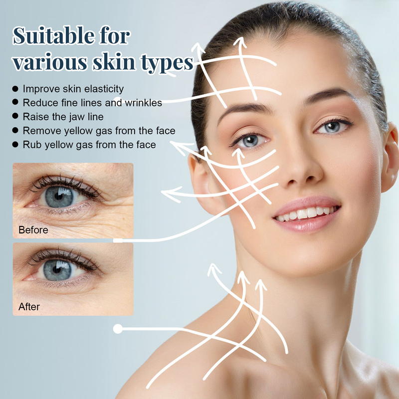Linea proteica Collagene Assorbibile Lifting Filo Antirughe V-face Lifting Rassodante Schiarente Linee sottili Filler Viso Anti-invecchiamento_voghion.com