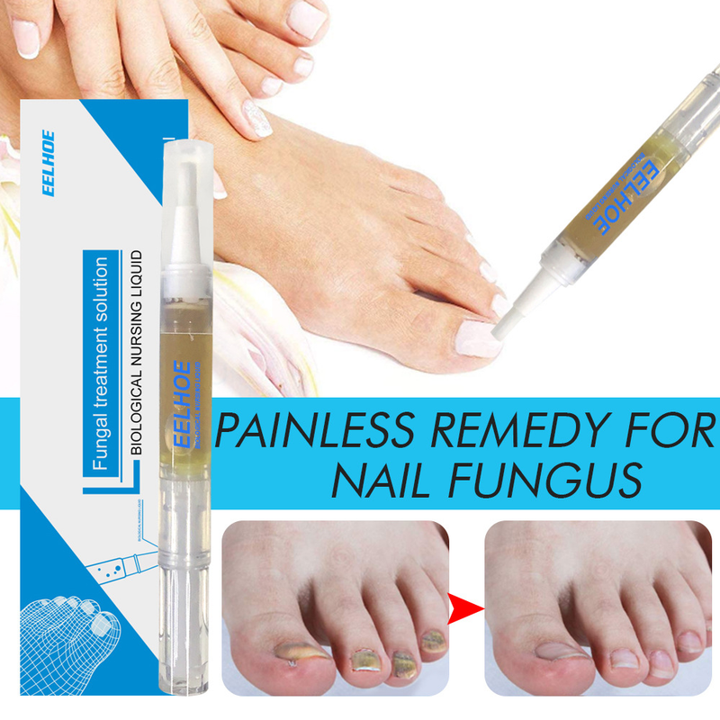 Nail Repair Beautiful Liquid Hand and Foot Grey Nail Care Repair Grey Nail Liquid Thickens Soft Nails s_voghion.com