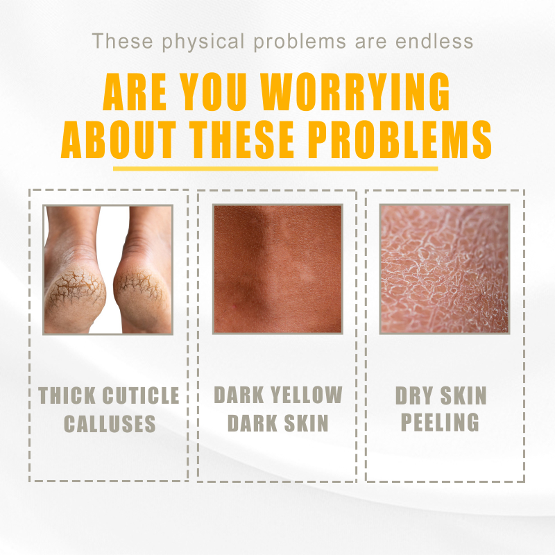Giel Peeling Ueleg Däischter Haut Bleechung Ewechzehuelen Aarm Knéi Been Melanin Kierper Peeling Brightening Whitening Beauty S_voghion.com