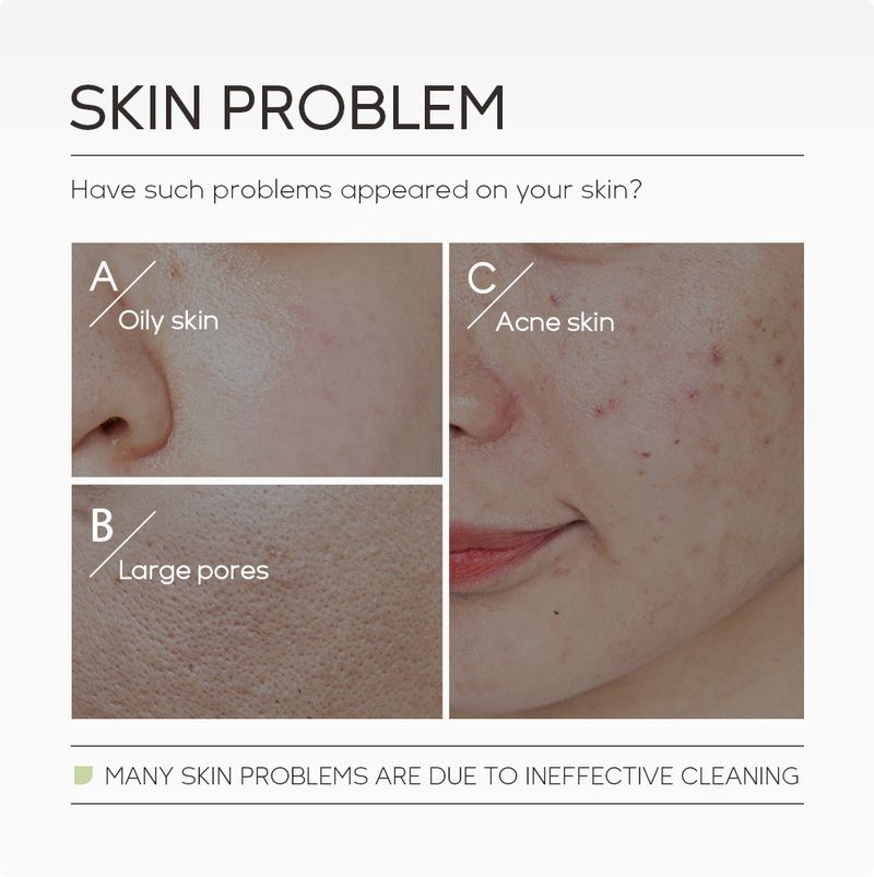 Scrubs & Bodys Treatments Clarifying Mask Laike Artemisia Cleansing Mud Mask FDA Skin Care 100g Cleansing Hydrating Moisturizing_voghion.com