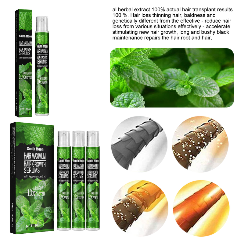 10/30 ml Haarwachstumsspray, schnell wachsendes Haaröl, Haarausfallkur für dünner werdendes Haar, Wachstumsspray, Produkte, Haarpflege für Frauen, Männer, Männer_voghion.com