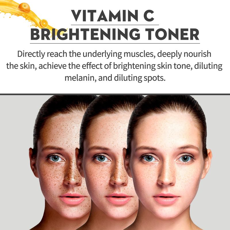 EELHOE Vitamin C Brightening Toning Lotion for Reducing Acne Marks Spots, Refreshing, Moisturizing, Firming, and_voghion.com