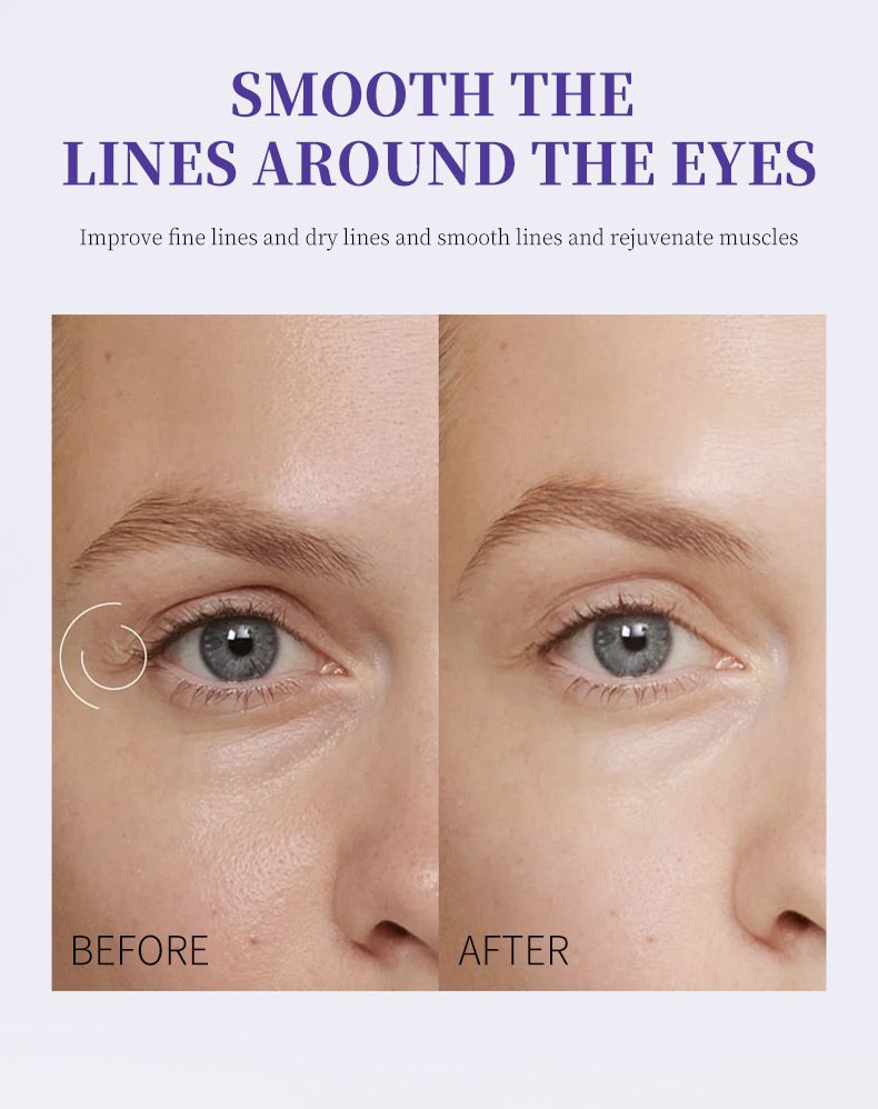 TVLV Roller Anti Wrinkle Smooth Eye Cream 20g Moisturizing And Hydrating To Reduce Fine Lines And Massage Eye Essence Cream_voghion.com