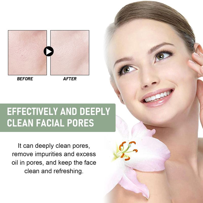 Demachiantul Hoygi Pore Cleansing iluminează pielea feței, curăță în profunzime petele de acnee, curăță, hidratează și hidratează._voghion.com
