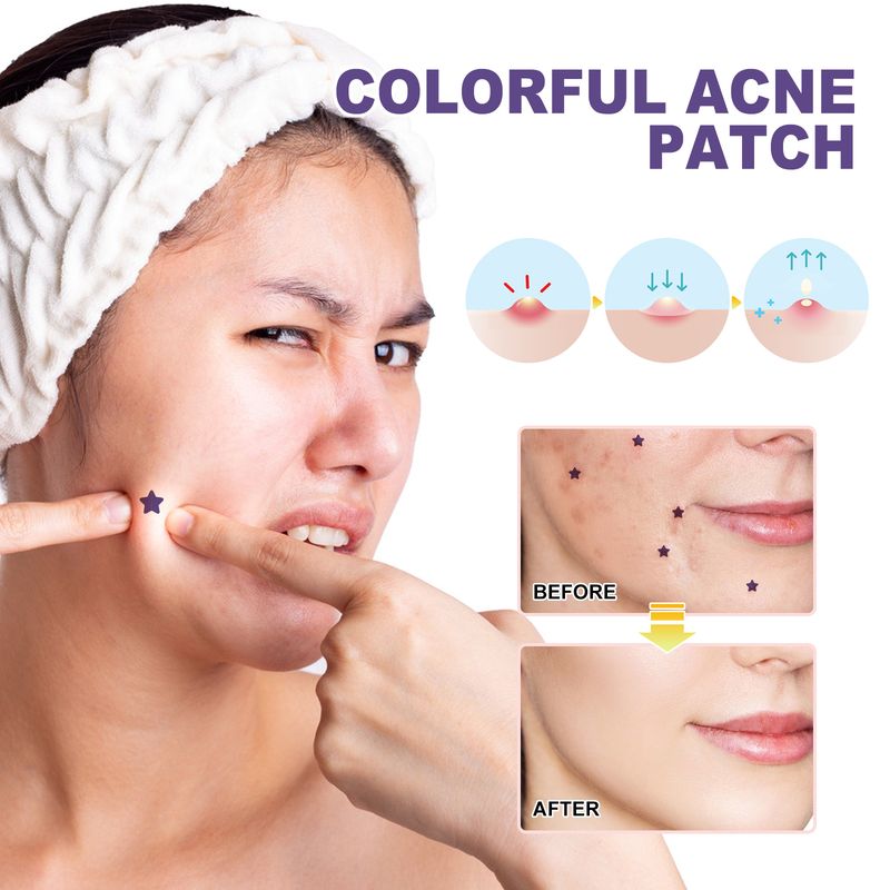 Hoygi Colorful Acne Patch, Repair Acne Closing Mild Non-Irritating Smooth Skin Acne Patch_voghion.com