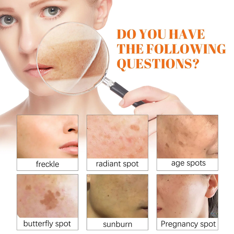 Papaya Day Night Cream Fjern mørke pletter Melanin Sorte Prikker Melasma Remover Anti Pigmentation Brighten Whitening Freckle Cream_voghion.com