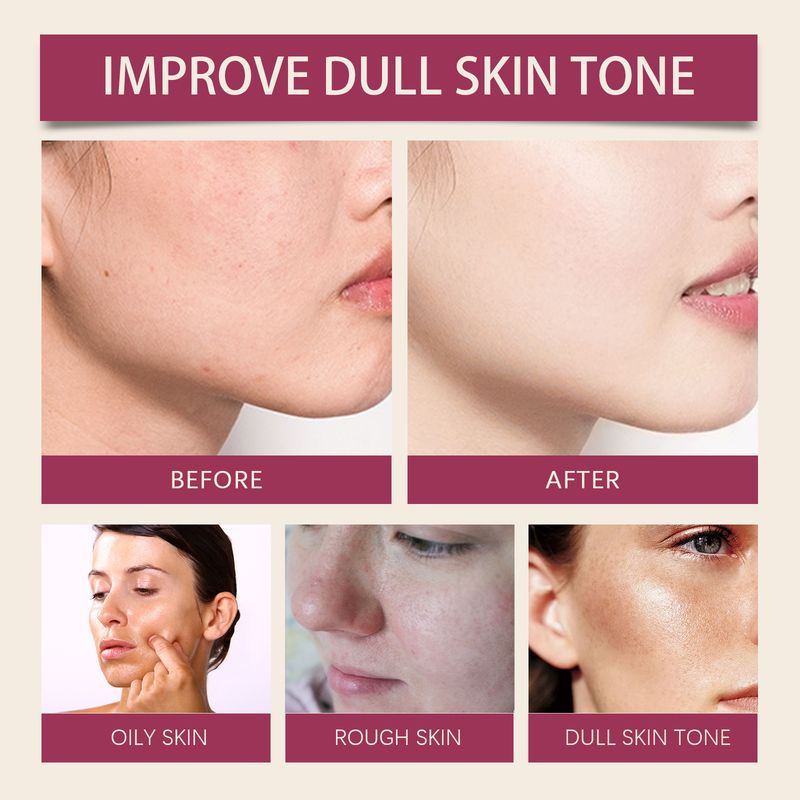 OUHOE Fruit Acid Purifying Essence, Gentle Exfoliating, Moisturizing And Moisturizing Daily Skin Care Essence_voghion.com