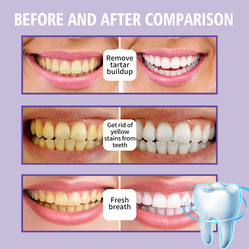 Il dentifricio in mousse Jaysuing pulisce le macchie di tartaro, illumina i denti bianchi, rinfresca l'alitosi e si prende cura delle gengive_voghion.com